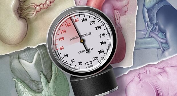 Hypertension is characterized by systolic blood pressure values ​​above 140 mmHg. 